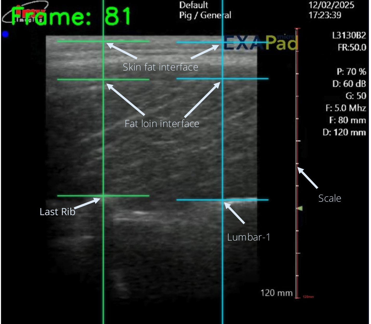 B-mode ultrasound image at the last rib with the skin-fat interface, fat-loin interface, and last rib annotated.